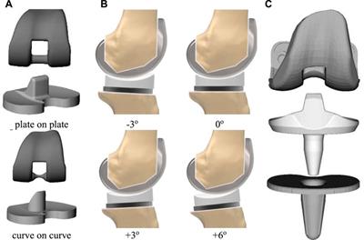 A review on flexion angle in high-flexion total knee arthroplasty for indonesian’s need